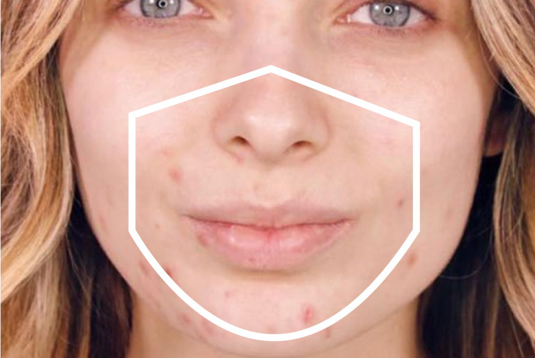 mask